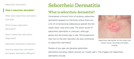 Seborrheic Dermatitis Main Page - Dermatitis Academy