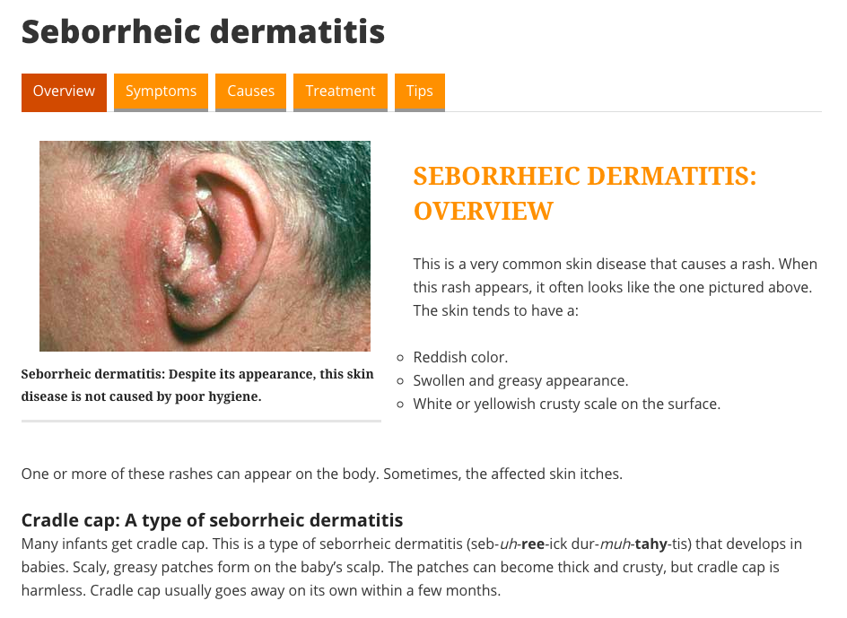 Seborrheic Dermatitis Main Page Dermatitis Academy 1664